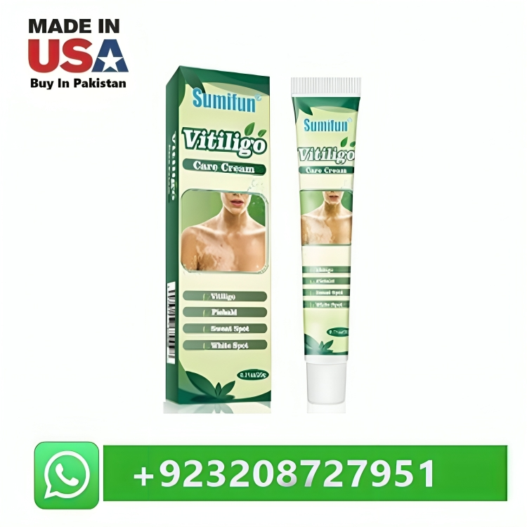 Best Vitiligo Cream in Pakistan 03208727951